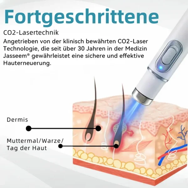 𝐉𝐚𝐬𝐬𝐞𝐞𝐦® 𝐍𝐢𝐜𝐡𝐭-𝐢𝐧𝐯𝐚𝐬𝐢𝐯 𝐋𝐞𝐛𝐞𝐫𝐟𝐥𝐞𝐜𝐤- 𝐮𝐧𝐝 𝐖𝐚𝐫𝐳𝐞𝐧𝐞𝐧𝐭𝐟𝐞𝐫𝐧𝐮𝐧𝐠𝐬-𝐋𝐚𝐬𝐞𝐫𝐬𝐭𝐢𝐟𝐭