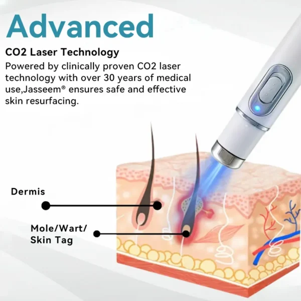 𝐉𝐚𝐬𝐬𝐞𝐞𝐦® Medical-Grade Laser Pen