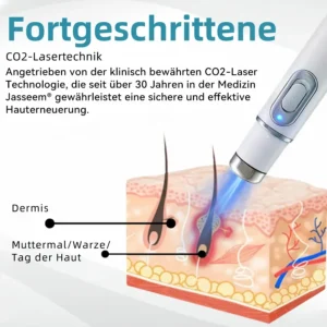 𝐉𝐚𝐬𝐬𝐞𝐞𝐦® Nicht-invasive Laserstift zur Entfernung von Hautflecken und Warzen