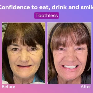 𝐉𝐚𝐬𝐬𝐞𝐞𝐦®👩‍⚕️🎉𝐍𝐞𝐱𝐭-𝐆𝐞𝐧 𝐂𝐨𝐦𝐟𝐨𝐫𝐭 𝐃𝐞𝐧𝐭𝐮𝐫𝐞(🦷𝐋𝐢𝐦𝐢𝐭𝐞𝐝 𝐭𝐢𝐦𝐞 𝐝𝐢𝐬𝐜𝐨𝐮𝐧𝐭 𝐋𝐚𝐬𝐭 𝟑𝟎 𝐦𝐢𝐧𝐮𝐭𝐞𝐬🦷)