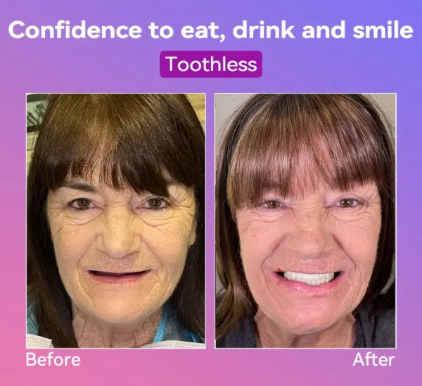 𝐉𝐚𝐬𝐬𝐞𝐞𝐦®👩‍⚕️🎉𝐍𝐞𝐱𝐭-𝐆𝐞𝐧 𝐂𝐨𝐦𝐟𝐨𝐫𝐭 𝐃𝐞𝐧𝐭𝐮𝐫𝐞(🦷𝐋𝐢𝐦𝐢𝐭𝐞𝐝 𝐭𝐢𝐦𝐞 𝐝𝐢𝐬𝐜𝐨𝐮𝐧𝐭 𝐋𝐚𝐬𝐭 𝟑𝟎 𝐦𝐢𝐧𝐮𝐭𝐞𝐬🦷)