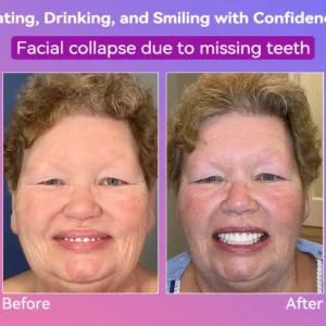 𝐉𝐚𝐬𝐬𝐞𝐞𝐦®👩‍⚕️🎉𝐍𝐞𝐱𝐭-𝐆𝐞𝐧 𝐂𝐨𝐦𝐟𝐨𝐫𝐭 𝐃𝐞𝐧𝐭𝐮𝐫𝐞(🦷𝐋𝐢𝐦𝐢𝐭𝐞𝐝 𝐭𝐢𝐦𝐞 𝐝𝐢𝐬𝐜𝐨𝐮𝐧𝐭 𝐋𝐚𝐬𝐭 𝟑𝟎 𝐦𝐢𝐧𝐮𝐭𝐞𝐬🦷)