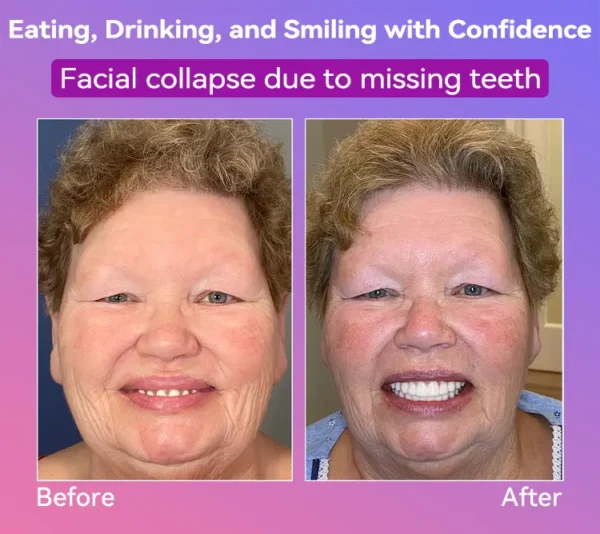 𝐉𝐚𝐬𝐬𝐞𝐞𝐦®👩‍⚕️🎉𝐍𝐞𝐱𝐭-𝐆𝐞𝐧 𝐂𝐨𝐦𝐟𝐨𝐫𝐭 𝐃𝐞𝐧𝐭𝐮𝐫𝐞(🦷𝐋𝐢𝐦𝐢𝐭𝐞𝐝 𝐭𝐢𝐦𝐞 𝐝𝐢𝐬𝐜𝐨𝐮𝐧𝐭 𝐋𝐚𝐬𝐭 𝟑𝟎 𝐦𝐢𝐧𝐮𝐭𝐞𝐬🦷)