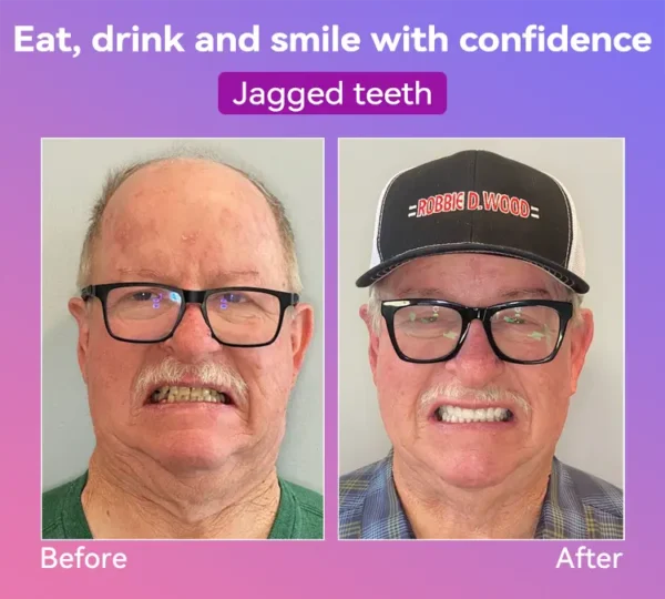 𝐉𝐚𝐬𝐬𝐞𝐞𝐦®👩‍⚕️🎉𝐍𝐞𝐱𝐭-𝐆𝐞𝐧 𝐂𝐨𝐦𝐟𝐨𝐫𝐭 𝐃𝐞𝐧𝐭𝐮𝐫𝐞(🦷𝐋𝐢𝐦𝐢𝐭𝐞𝐝 𝐭𝐢𝐦𝐞 𝐝𝐢𝐬𝐜𝐨𝐮𝐧𝐭 𝐋𝐚𝐬𝐭 𝟑𝟎 𝐦𝐢𝐧𝐮𝐭𝐞𝐬🦷)