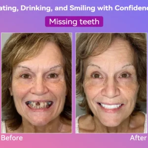 𝐉𝐚𝐬𝐬𝐞𝐞𝐦®👩‍⚕️🎉𝐍𝐞𝐱𝐭-𝐆𝐞𝐧 𝐂𝐨𝐦𝐟𝐨𝐫𝐭 𝐃𝐞𝐧𝐭𝐮𝐫𝐞(🦷𝐋𝐢𝐦𝐢𝐭𝐞𝐝 𝐭𝐢𝐦𝐞 𝐝𝐢𝐬𝐜𝐨𝐮𝐧𝐭 𝐋𝐚𝐬𝐭 𝟑𝟎 𝐦𝐢𝐧𝐮𝐭𝐞𝐬🦷)