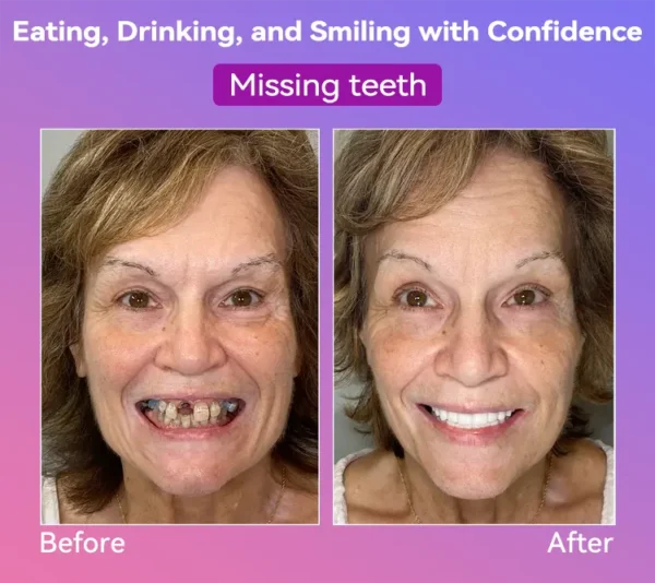 𝐉𝐚𝐬𝐬𝐞𝐞𝐦®👩‍⚕️🎉𝐍𝐞𝐱𝐭-𝐆𝐞𝐧 𝐂𝐨𝐦𝐟𝐨𝐫𝐭 𝐃𝐞𝐧𝐭𝐮𝐫𝐞(🦷𝐋𝐢𝐦𝐢𝐭𝐞𝐝 𝐭𝐢𝐦𝐞 𝐝𝐢𝐬𝐜𝐨𝐮𝐧𝐭 𝐋𝐚𝐬𝐭 𝟑𝟎 𝐦𝐢𝐧𝐮𝐭𝐞𝐬🦷)