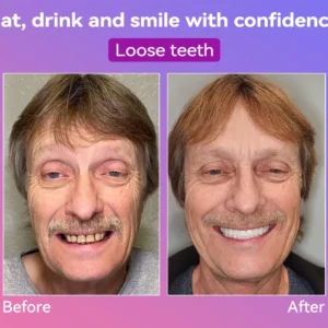 𝐉𝐚𝐬𝐬𝐞𝐞𝐦®👩‍⚕️🎉𝐍𝐞𝐱𝐭-𝐆𝐞𝐧 𝐂𝐨𝐦𝐟𝐨𝐫𝐭 𝐃𝐞𝐧𝐭𝐮𝐫𝐞(🦷𝐋𝐢𝐦𝐢𝐭𝐞𝐝 𝐭𝐢𝐦𝐞 𝐝𝐢𝐬𝐜𝐨𝐮𝐧𝐭 𝐋𝐚𝐬𝐭 𝟑𝟎 𝐦𝐢𝐧𝐮𝐭𝐞𝐬🦷)
