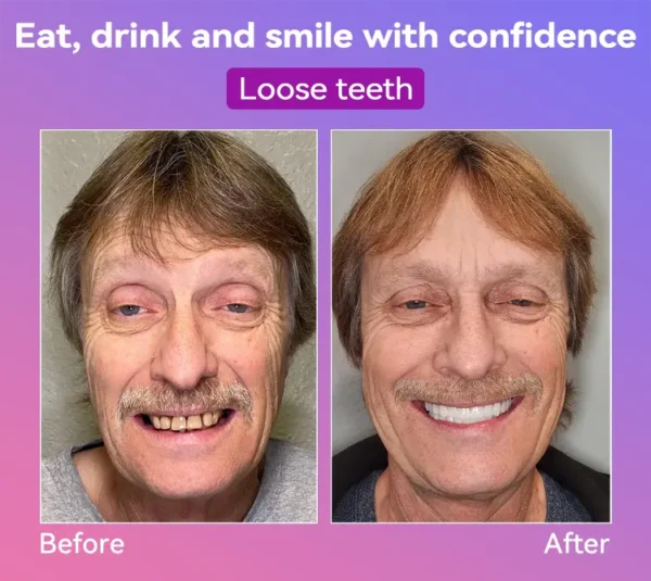 𝐉𝐚𝐬𝐬𝐞𝐞𝐦®👩‍⚕️🎉𝐍𝐞𝐱𝐭-𝐆𝐞𝐧 𝐂𝐨𝐦𝐟𝐨𝐫𝐭 𝐃𝐞𝐧𝐭𝐮𝐫𝐞(🦷𝐋𝐢𝐦𝐢𝐭𝐞𝐝 𝐭𝐢𝐦𝐞 𝐝𝐢𝐬𝐜𝐨𝐮𝐧𝐭 𝐋𝐚𝐬𝐭 𝟑𝟎 𝐦𝐢𝐧𝐮𝐭𝐞𝐬🦷)