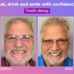 𝐉𝐚𝐬𝐬𝐞𝐞𝐦®👩‍⚕️🎉𝐍𝐞𝐱𝐭-𝐆𝐞𝐧 𝐂𝐨𝐦𝐟𝐨𝐫𝐭 𝐃𝐞𝐧𝐭𝐮𝐫𝐞(🦷𝐋𝐢𝐦𝐢𝐭𝐞𝐝 𝐭𝐢𝐦𝐞 𝐝𝐢𝐬𝐜𝐨𝐮𝐧𝐭 𝐋𝐚𝐬𝐭 𝟑𝟎 𝐦𝐢𝐧𝐮𝐭𝐞𝐬🦷)