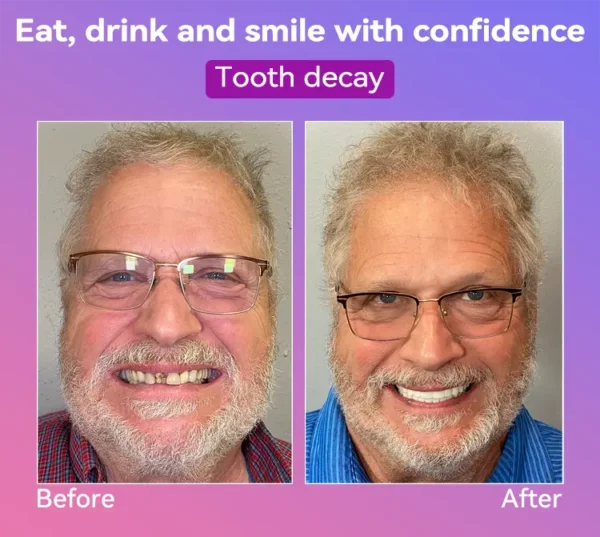 𝐉𝐚𝐬𝐬𝐞𝐞𝐦®👩‍⚕️🎉𝐍𝐞𝐱𝐭-𝐆𝐞𝐧 𝐂𝐨𝐦𝐟𝐨𝐫𝐭 𝐃𝐞𝐧𝐭𝐮𝐫𝐞(🦷𝐋𝐢𝐦𝐢𝐭𝐞𝐝 𝐭𝐢𝐦𝐞 𝐝𝐢𝐬𝐜𝐨𝐮𝐧𝐭 𝐋𝐚𝐬𝐭 𝟑𝟎 𝐦𝐢𝐧𝐮𝐭𝐞𝐬🦷)