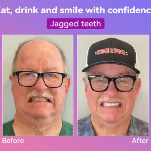 𝐉𝐚𝐬𝐬𝐞𝐞𝐦®👩‍⚕️🥇𝐍𝐞𝐱𝐭-𝐆𝐞𝐧 𝐂𝐨𝐦𝐟𝐨𝐫𝐭 𝐃𝐞𝐧𝐭𝐮𝐫𝐞(🦷𝐋𝐢𝐦𝐢𝐭𝐞𝐝 𝐭𝐢𝐦𝐞 𝐝𝐢𝐬𝐜𝐨𝐮𝐧𝐭 𝐋𝐚𝐬𝐭 𝟑𝟎 𝐦𝐢𝐧𝐮𝐭𝐞𝐬🦷)
