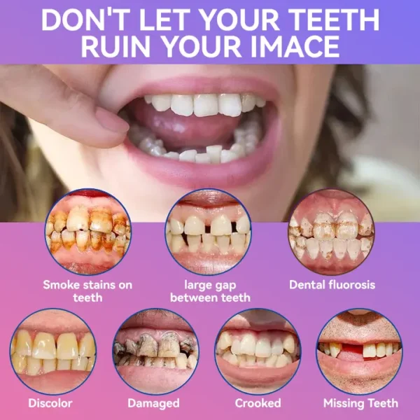 𝐉𝐚𝐬𝐬𝐞𝐞𝐦®👩‍⚕️🥇𝐍𝐞𝐱𝐭-𝐆𝐞𝐧 𝐂𝐨𝐦𝐟𝐨𝐫𝐭 𝐃𝐞𝐧𝐭𝐮𝐫𝐞(🦷𝐋𝐢𝐦𝐢𝐭𝐞𝐝 𝐭𝐢𝐦𝐞 𝐝𝐢𝐬𝐜𝐨𝐮𝐧𝐭 𝐋𝐚𝐬𝐭 𝟑𝟎 𝐦𝐢𝐧𝐮𝐭𝐞𝐬🦷)