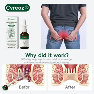 🖤🔥𝘽𝙡𝙖𝙘𝙠 𝙁𝙧𝙞𝙙𝙖𝙮 𝙨𝙖𝙡𝙚 | Cvreoz® Fast Hemorrhoid PRO Spray