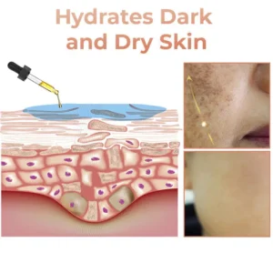 2025s,NESLEMY™ Fast Dark Spot Remover ✨ Where science meets luxury. Our melanin-correcting serum erase