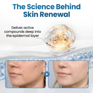 Biancat® BumpFlatten Cream (A)