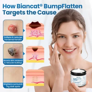 Biancat® BumpFlatten Cream🇬🇧 XH-BumpFlatten-UPSELL