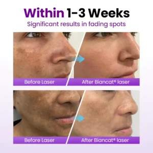 Biancat® SpotErase Probiotic Shield Serum 🇬🇧 XH-SpotErase-upsell