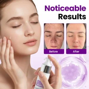 Biancat® SpotErase Probiotic Shield Serum (A)