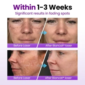 Biancat® SpotErase Probiotic Shield Serum (A)