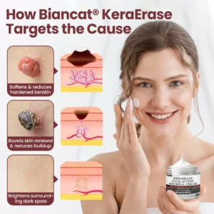 Biancat®KeraErase Dual-Action Renewal Cream (Copy)