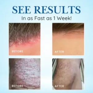 Cvreoz® Source-Relief Magnesium Spray