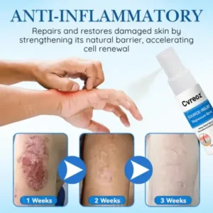 Cvreoz® Source-Relief Magnesium Spray