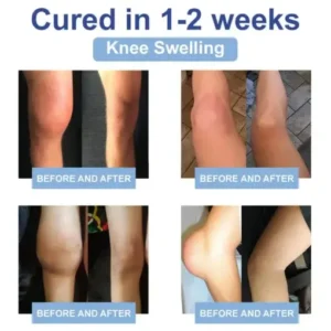 LOVILDS® Black Rice Pain Healing Bone Cream