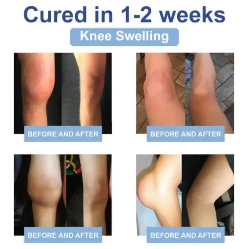 LOVILDS® Black Rice Pain Healing Bone Cream