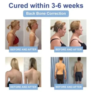 LOVILDS® Black Rice Pain Healing Bone Cream