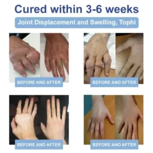 LOVILDS® Black Rice Pain Healing Bone Cream