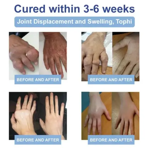 LOVILDS® Black Rice Pain Healing Bone Cream