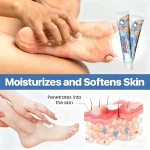 LOVILDS™ Diabetic  Skin Treatment Cream，Diabetics, This Cream Could Save Your Feet