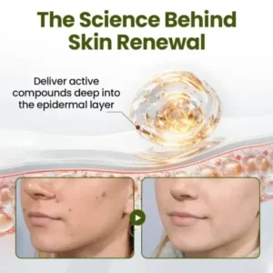 LOVILDS® MagneErase Renewal Cream