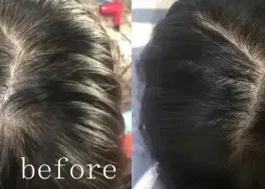 Lovilds® Hair Restoration Spray ( Reawaken Your Roots. Regrow Naturally. ✨ Clinically Proven Hair Regrowth Within 4 Weeks ✨)