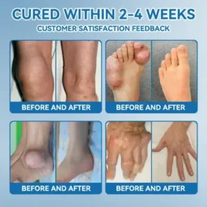 Ourlyard”® 𝐁𝐏𝐂-𝟏𝟓𝟕 𝐉𝐨𝐢𝐧𝐭 𝐇𝐞𝐚𝐥𝐢𝐧𝐠 Capsules