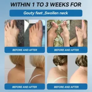 Ourlyard”® 𝐁𝐏𝐂-𝟏𝟓𝟕 𝐉𝐨𝐢𝐧𝐭 𝐇𝐞𝐚𝐥𝐢𝐧𝐠 Capsules