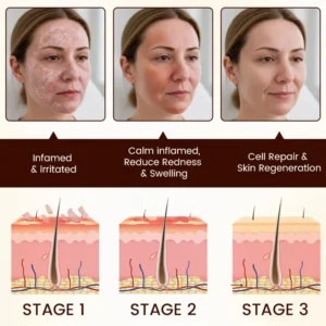 Timilk® Bee Venom Multi-Repair Cream