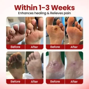 Timilk® VitaGluco Diabetic Care Cream