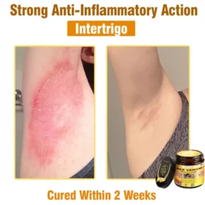 𝐋𝐎𝐕𝐈𝐋𝐃𝐒™ 𝐁𝐞𝐞 𝐕𝐞𝐧𝐨𝐦 𝐀𝐥𝐥-𝐢𝐧-𝐎𝐧𝐞 𝐂𝐫𝐞𝐚𝐦–🌸 Anti-Aging, Hydrating & Skin Repair