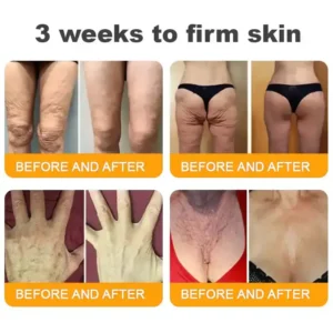 𝐋𝐎𝐕𝐈𝐋𝐃𝐒™ 𝐁𝐞𝐞 𝐕𝐞𝐧𝐨𝐦 𝐀𝐥𝐥-𝐢𝐧-𝐎𝐧𝐞 𝐂𝐫𝐞𝐚𝐦–🌸 Anti-Aging, Hydrating & Skin Repair