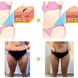 🌸LOVILDS™ 𝐀𝐝𝐯𝐚𝐧𝐜𝐞𝐝 𝐅𝐢𝐫𝐦𝐢𝐧𝐠 & 𝐖𝐫𝐢𝐧𝐤𝐥𝐞-𝐑𝐞𝐝𝐮𝐜𝐢𝐧𝐠 𝐂𝐫𝐞𝐚𝐦 Pro