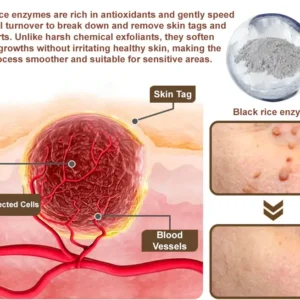 LOVILDS® Black Rice Soothing Repair Cream ⚕️