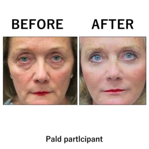 [Official Brand Store]🍁💖Furzero® Lift & Firm Instant Skin Tightener