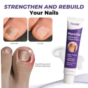 Timilk® MycoOut Natural Nail Fungus Solution