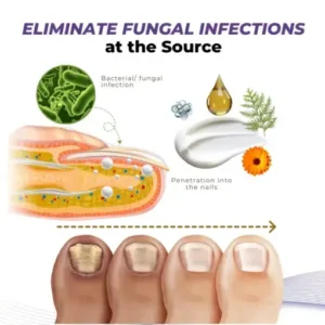 Timilk® MycoOut Natural Nail Fungus Solution