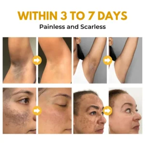 Biancat® VenoBright Bee Venom Advanced Brightening Cream⭐