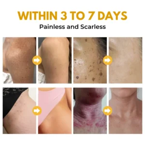 Biancat® VenoBright Bee Venom Advanced Brightening Cream⭐