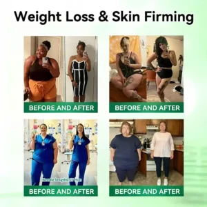 Flagship store LOVILDS® 𝑴𝒐𝒓𝒊𝒏𝒈𝒂 & 𝑩𝒆𝒓𝒃𝒆𝒓𝒊𝒏𝒆 10-𝑰𝑵-1 𝑨𝒅𝒗𝒂𝒏𝒄𝒆𝒅 𝑵𝒂𝒏𝒐 𝑴𝒊𝒄𝒓𝒐𝒏𝒆𝒆𝒅𝒍𝒆 𝑷𝒂𝒕𝒄𝒉 (𝐎𝐧𝐜𝐞 𝐃𝐚𝐢𝐥𝐲, 𝐯𝐢𝐬𝐢𝐛𝐥𝐞 𝐜𝐡𝐚𝐧𝐠𝐞𝐬 𝐢𝐧 𝟕 𝐝𝐚𝐲𝐬） 𝐎𝐛𝐞𝐬𝐢𝐭𝐲, 𝐃𝐢𝐚𝐛𝐞𝐭𝐞𝐬, 𝐒𝐥𝐞𝐞𝐩 𝐀𝐩𝐧𝐞𝐚, 𝐀𝐧𝐝 𝐉𝐨𝐢𝐧𝐭 𝐈𝐬𝐬𝐮𝐞𝐬