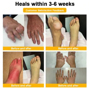 LOVILDS™  Bee Venom  Pain-Relief Bone Healing Cream 🎉🎉(Specially for older adults)