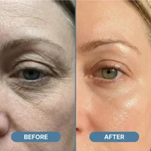 LOVILDS™ Tallow Honey Grease with Methylene – Naturally Hydrates to Restore Balance and Prevent Aging